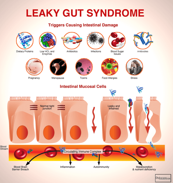 Leaky Gut