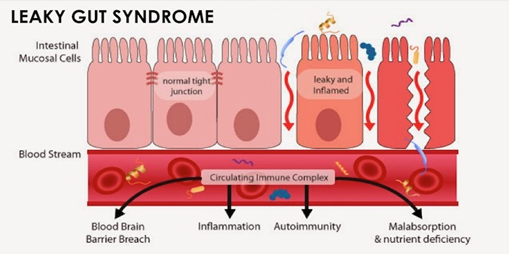 Why do I need my microbiome to remain in balance?